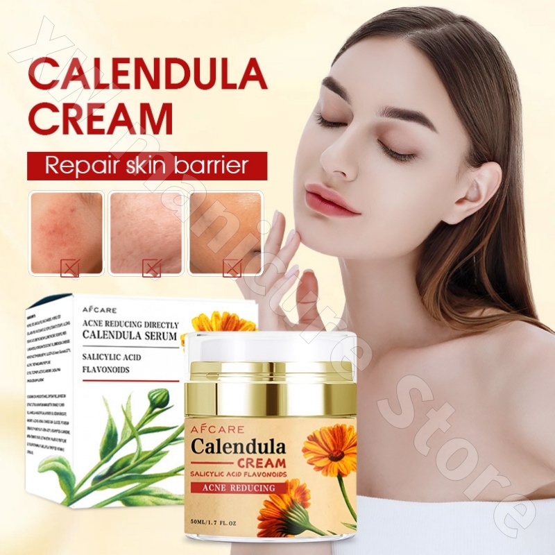Luxury Skincare Whitening Cream - Herstellende Calendula Cream Hydraterende en verjongende