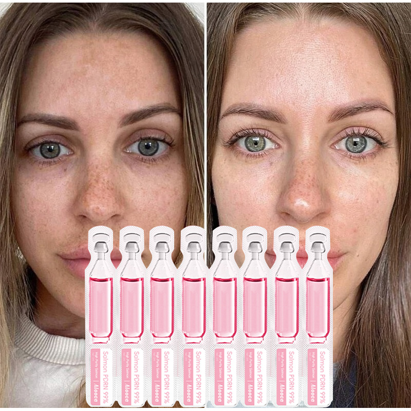 Zalmserum Eiwit Peptide Essent - Peptide Complex Serum recensie en prijs