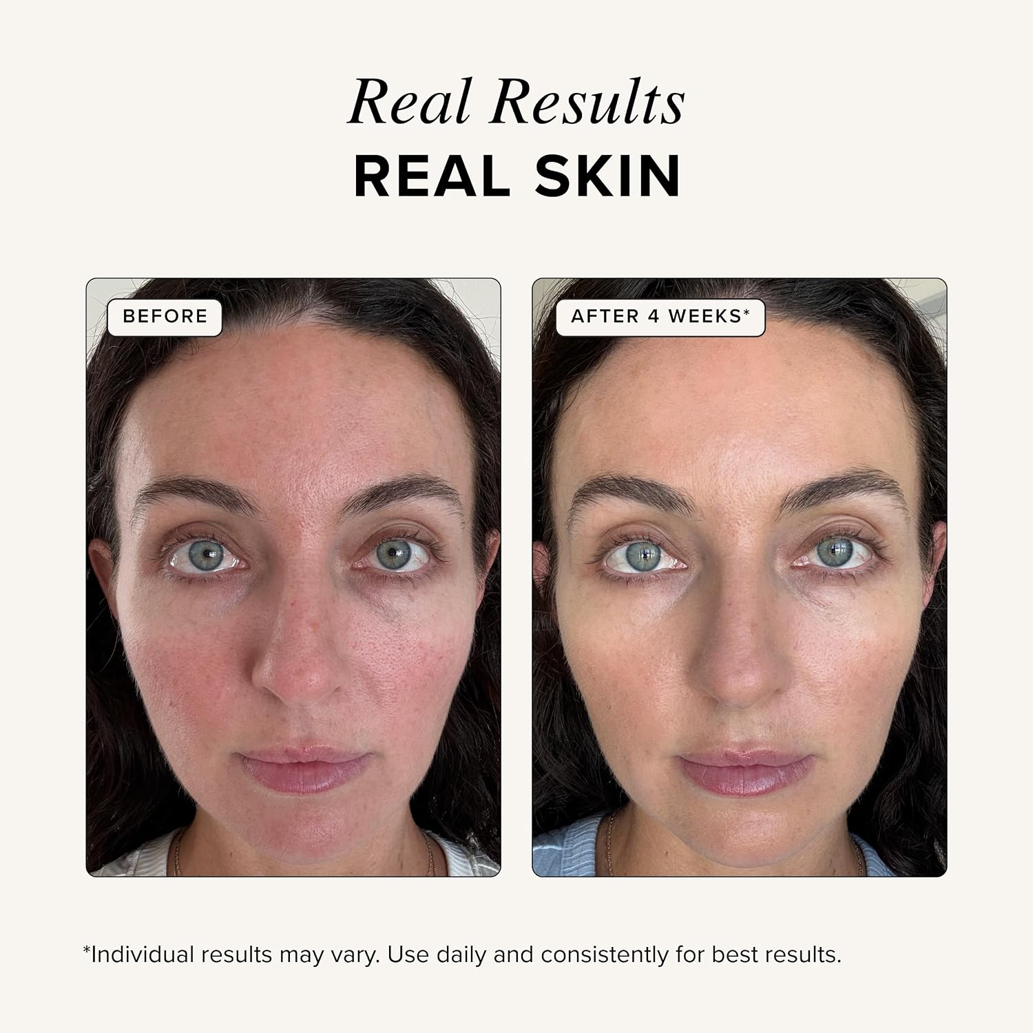 Koper Peptide Serum Anti Rimpe - Peptide Complex Serum recensie en prijs