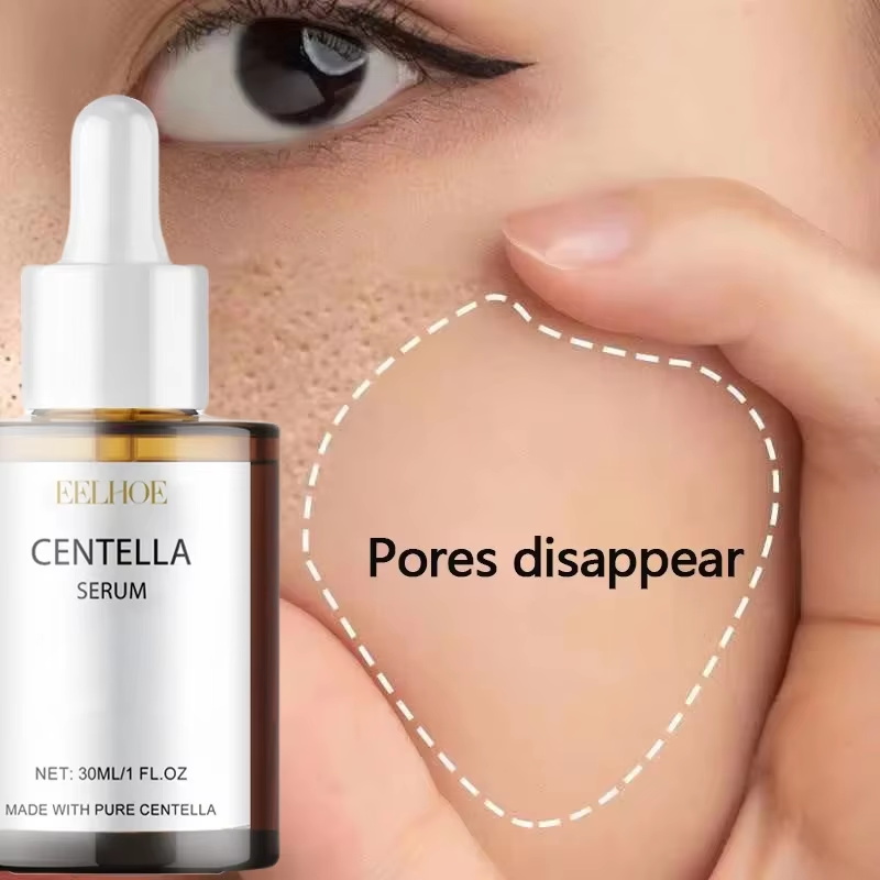 Centella Asiatica Serum voor h - Luxury Skincare Korea recensie en prijs
